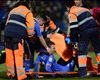'I've never seen anything like it' - Alexis suffers testicle injury