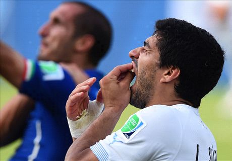 Suarez facing legal action after bite