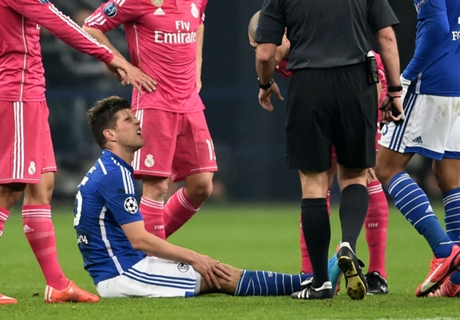 Scheenbeen Huntelaar zwaar gekneusd